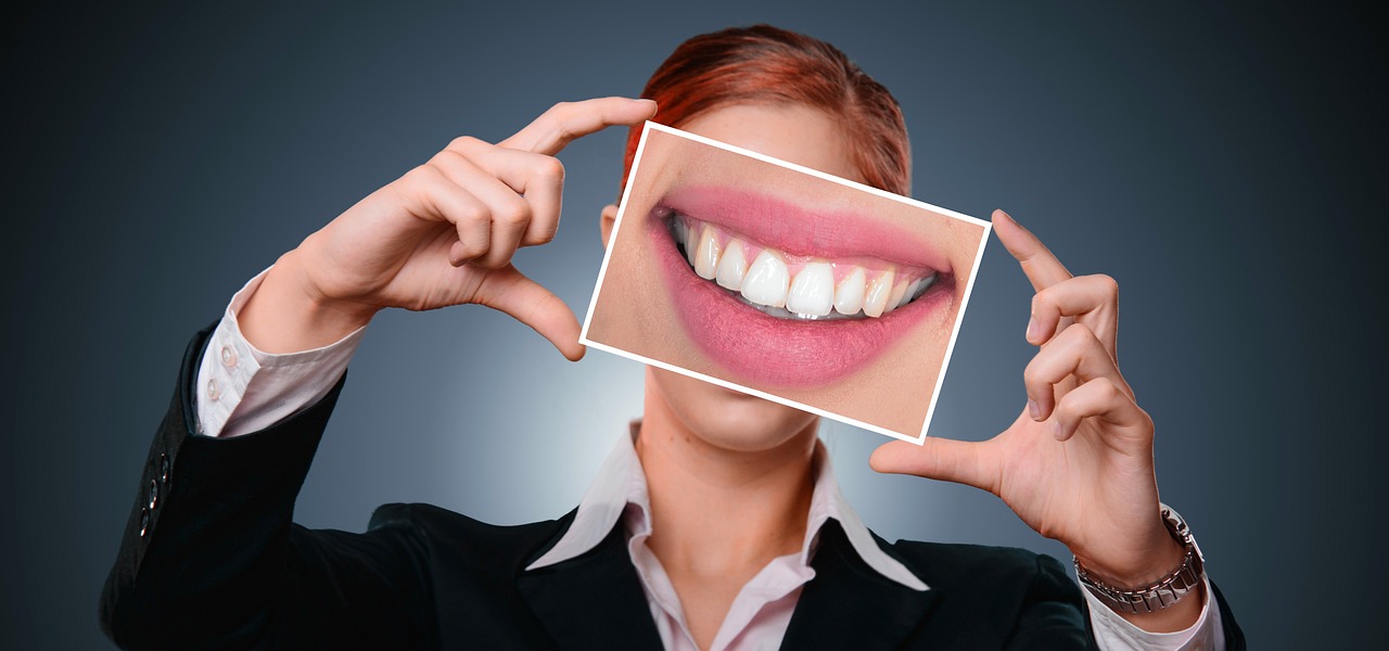 Sigilarea fisurilor și a șanțurilor dentare – metoda modernă de prevenție pentru sănătatea dinților